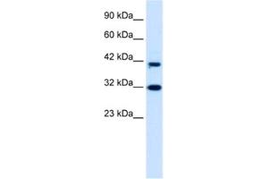 Western Blotting (WB) image for anti-D4, Zinc and Double PHD Fingers Family 1 (DPF1) antibody (ABIN2460940) (DPF1 Antikörper)