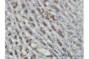 Image no. 2 for anti-RAS and EF Hand Domain Containing (RASEF) (AA 631-740) antibody (ABIN599333) (RASEF Antikörper  (AA 631-740))