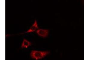 ABIN6275794 staining Hela cells by IF/ICC. (MYL7 Antikörper)