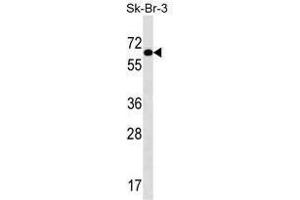 TRIP4 Antibody (Center) western blot analysis in SK-BR-3 cell line lysates (35 µg/lane). (TRIP4 Antikörper  (Middle Region))