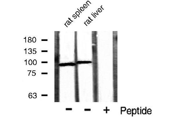 CTNNB1 Antikörper  (N-Term)