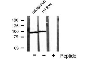 Western blot analysis of extracts of various sample,using Catenin-β antibody. (CTNNB1 Antikörper  (N-Term))