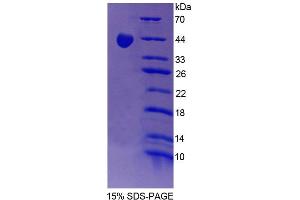 SDS-PAGE (SDS) image for Protein Phosphatase 1, Regulatory (Inhibitor) Subunit 15A (PPP1R15A) (AA 335-578) protein (His tag) (ABIN6239051) (GADD34 Protein (AA 335-578) (His tag))