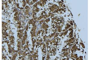 ABIN6276283 at 1/100 staining Mouse testis tissue by IHC-P. (Prohibitin Antikörper  (Internal Region))
