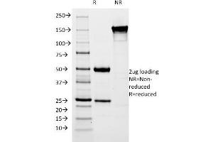 SDS-PAGE Analysis Purified pS2 Mouse Monoclonal Antibody (SPM313).