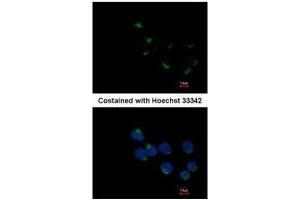 ICC/IF Image Immunofluorescence analysis of methanol-fixed A431, using GALNT6, antibody at 1:200 dilution. (GALNT6 Antikörper)