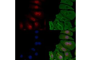 ABIN6257259 and ABIN6274296 staining Hela cells by IF/ICC. (HNRNPH1 Antikörper  (Internal Region))