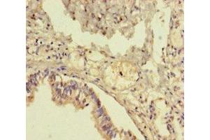 Immunohistochemistry of paraffin-embedded human lung tissue using ABIN7173257 at dilution of 1:100 (TMEM64 Antikörper  (AA 40-118))