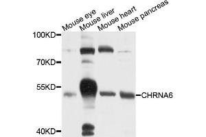 Western blot analysis of extracts of various cells, using CHRNA6 antibody. (CHRNA6 Antikörper)
