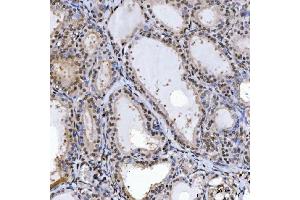 IHC analysis of SPT5/SUPT5H using anti-SPT5/SUPT5H antibody (ABIN7601985). (SUPT5H Antikörper  (AA 533-1087))