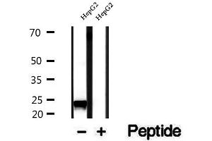 Western blot analysis of extracts of HepG2 cells, using RAB14 antibody. (RAB14 Antikörper  (C-Term))