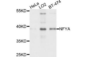 Western blot analysis of extract of various cells, using NFYA antibody. (NFYA Antikörper)
