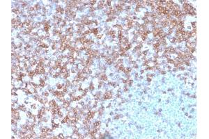 Formalin-fixed, paraffin-embedded human spleen stained with CD43 Mouse Monoclonal Antibody (SPN/3388). (CD43 Antikörper)