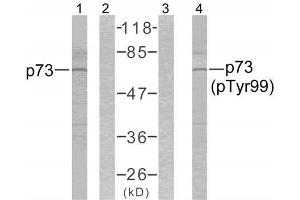 Western blot analysis of the extracts from K562 cells using p73 (Ab-99) antibody (E021075, Lane 1 and 2) and p73 (phospho-Tyr99) antibody (E011058, Lane 3 and 4). (Tumor Protein p73 Antikörper)