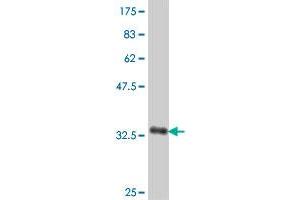 Western Blotting (WB) image for anti-Solute Carrier Organic Anion Transporter Family, Member 1B1 (SLCO1B1) (AA 481-570) antibody (ABIN564624)