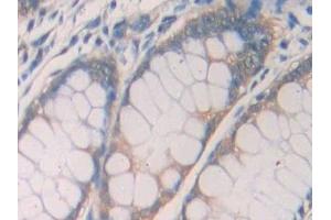 Immunohistochemistry (IHC) image for anti-Interleukin 1 Receptor, Type I (IL1R1) (AA 226-318) antibody (ABIN7437953)