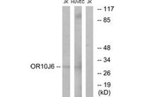 Western blot analysis of extracts from Jurkat/HuvEc cells, using OR10J6 Antibody.
