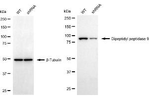 Western blotting analysis using dipeptidyl peptidase 9 antibody (ABIN7798348). (DPP9 Antikörper)