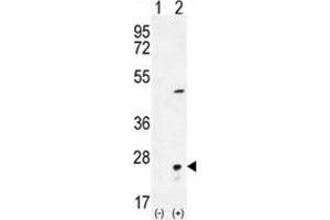 Western blot analysis of VSNL1 (arrow) using rabbit polyclonal VSNL1 Antibody (Center) .