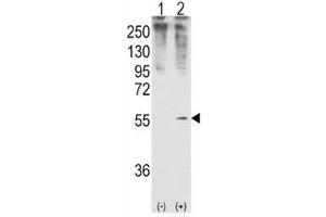 Western blot analysis of GDF11 antibody and 293 cell lysate (2 ug/lane) either nontransfected (Lane 1) or transiently transfected with the GDF11 gene (2).