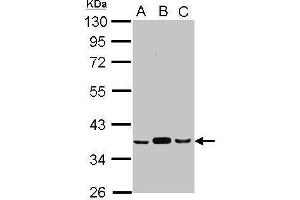 WB Image Sample (30 ug of whole cell lysate) A: A549 B: H1299 C: HCT116 10% SDS PAGE antibody diluted at 1:1000 (PDHE1-B Antikörper)