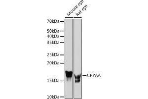 Western blot analysis of extracts of various cell lines, using CRYAA Rabbit mAb (ABIN7266527) at 1:1000 dilution. (CRYAA Antikörper)