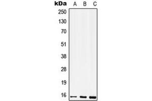 Western blot analysis of CD52 expression in THP1 (A), mouse spleen (B), H9C2 (C) whole cell lysates. (CD52 Antikörper  (N-Term))