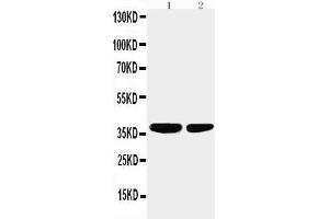 Western Blotting (WB) image for anti-Protein Phosphatase 2, Catalytic Subunit, alpha Isozyme (PPP2CA) (AA 6-20), (N-Term) antibody (ABIN3044492) (PPP2CA Antikörper  (N-Term))