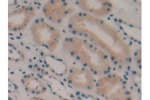 Immunohistochemistry (IHC) image for anti-3-Hydroxy-3-Methylglutaryl-CoA Synthase 1 (Soluble) (HMGCS1) (AA 293-467) antibody (ABIN7434026)