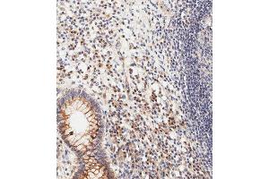 Immunohistochemical analysis of paraffin-embedded human epityphlon tissue using (ABIN1981278 and ABIN2845115) performed on the Leica® BOND RXm. (CDKN2A Antikörper  (C-Term))