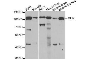 Western blot analysis of extracts of various cell lines, using MFI2 antibody. (MFI2 Antikörper  (AA 20-200))