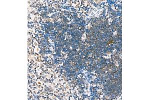 Immunohistochemistry of paraffin embedded mouse thymus using Skar (ABIN7074970) at dilution of 1:1800 (400x lens) (p46 Antikörper)