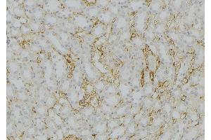 ABIN6272567 at 1/100 staining Mouse kidney tissue by IHC-P. (CYP11B2 Antikörper  (Internal Region))