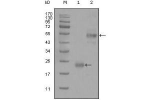Western blot analysis using CD44 mouse mAb against truncated Trx-CD44 recombinant protein (1) and GST-CD44 (aa628-699) recombinant protein (2). (CD44 Antikörper)