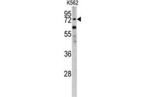 Western blot analysis of PLZF antibody (C-term) in K562 cell line lysates (35ug/lane). (ZBTB16 Antikörper  (C-Term))