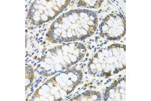 Immunohistochemistry of paraffin-embedded human colon using GNE antibody at dilution of 1:100 (x40 lens).