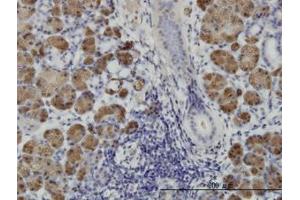 Image no. 1 for anti-Homeodomain Interacting Protein Kinase 1 (HIPK1) (AA 330-430) antibody (ABIN466275) (HIPK1 Antikörper  (AA 330-430))