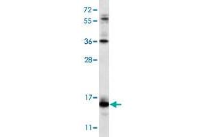 Western blot analysis of NCI-H460 cell lysate (35 ug/lane) with RCAN2 polyclonal antibody . (RCAN2 Antikörper  (N-Term))