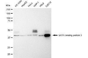 Western blotting analysis using GATA binding protein 3 antibody (ABIN7798695).