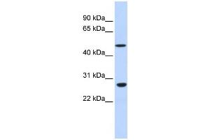 Western Blotting (WB) image for anti-Zinc Finger Protein 556 (ZNF556) antibody (ABIN2458203) (ZNF556 Antikörper)