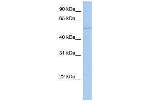 ALG1 antibody used at 1 ug/ml to detect target protein. (ALG1 Antikörper  (N-Term))