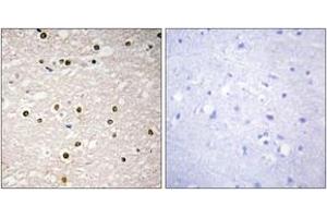Immunohistochemistry analysis of paraffin-embedded human brain tissue, using p73 Antibody. (Tumor Protein p73 Antikörper  (AA 271-320))