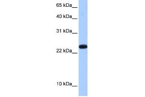 WB Suggested Anti-C19orf24 Antibody Titration:  0. (C19orf24 Antikörper  (N-Term))