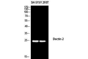 Western Blot (WB) analysis of SH-SY5Y 293T using Dectin-2 antibody. (C-Type Lectin Domain Family 6, Member A (CLEC6A) Antikörper)