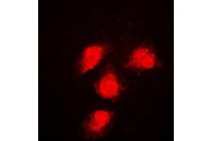 Immunofluorescent analysis of ERK1/2 staining in NIH3T3 cells. (ERK1/2 Antikörper  (Center))