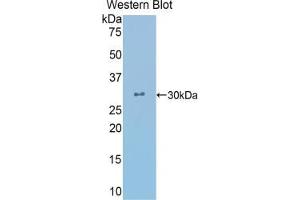 Western blot analysis of the recombinant protein. (CRYL1 Antikörper  (AA 24-232))
