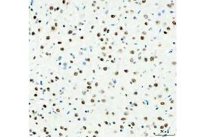 IHC analysis of DDX1 using anti-DDX1 antibody (ABIN7602052).