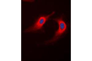 Immunofluorescent analysis of ABHD12B staining in K562 cells.