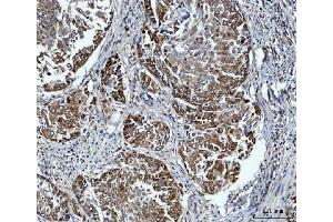 IHC analysis of FADS1 using anti-FADS1 antibody (ABIN7599175). (FADS1 Antikörper  (AA 1-257))
