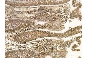 ZNF226 Mouse Monoclonal Antibody at 1/100 staining human normal colon tissue by IHC-P. (ZNF226 Antikörper)